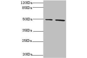 Western blot All lanes: NFS1 antibody at 6. (NFS1 Antikörper  (AA 208-457))