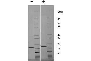 SDS-PAGE (SDS) image for Tumor Necrosis Factor alpha (TNF alpha) protein (ABIN6700749)
