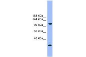 Image no. 1 for anti-StAR-Related Lipid Transfer (START) Domain Containing 8 (STARD8) (AA 181-230) antibody (ABIN6746634) (STARD8 Antikörper  (AA 181-230))