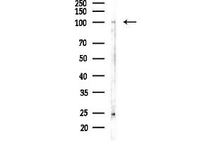 anti-Desmoglein 3 (DSG3) (C-Term) antibody