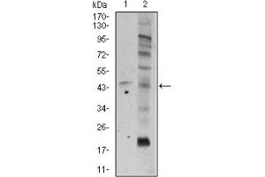 Western blot analysis using FZD5 antibody against A549 (1), and PC-3 (2) cell lysate. (FZD5 Antikörper  (AA 151-217))