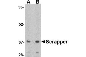Western Blotting (WB) image for anti-F-Box and Leucine-Rich Repeat Protein 20 (FBXL20) (N-Term) antibody (ABIN1031557) (FBXL20 Antikörper  (N-Term))