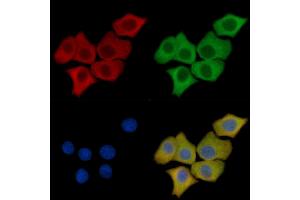 Cathepsin D Mouse Monoclonal Antibody staining HepG2 cells by IF/ICC. (Cathepsin D Antikörper  (C-Term))