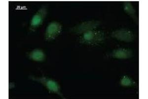 Immunostaining analysis in HeLa cells. (EIF4ENIF1 Antikörper)