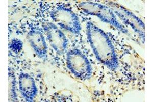 Immunohistochemistry of paraffin-embedded human duodenum tissue using ABIN7161653 at dilution of 1:100 (ULBP2 Antikörper  (AA 26-216))