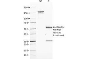 SDS-PAGE Analysis Purified ZAP70 Mouse Monoclonal Antibody (ZAP70/2046).