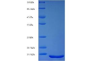 SDS-PAGE (SDS) image for SET Domain and Mariner Transposase Fusion Gene (SETMAR) (AA 1-118), (full length) protein (His tag) (ABIN5711303) (SETMAR Protein (AA 1-118, full length) (His tag))