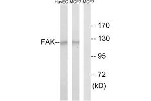 Western blot analysis of extracts from HUVEC cells and MCF-7 cells, using FAK (epitope around residue 843) antibody. (FAK Antikörper)
