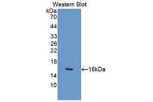 Detection of Recombinant IL17, Mouse using Polyclonal Antibody to Interleukin 17 (IL17)