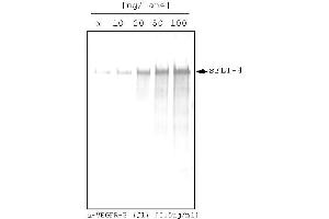 Western analysis (AP) using recombinant human soluble VEGFR-3/FLT-4 as target! (FLT4 Antikörper  (Extracellular Domain))