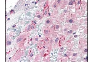 Image no. 1 for anti-Secreted phosphoprotein 1 (SPP1) (C-Term) antibody (ABIN372777) (Osteopontin Antikörper  (C-Term))