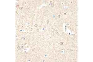 Immunohistochemistry of paraffin-embedded human brain using Guanylyl Cyclase beta 1 (GUCY1B3) (GUCY1B3) Rabbit mAb (ABIN7267551) at dilution of 1:100 (40x lens). (GUCY1B3 Antikörper)