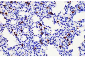 Immunohistochemistry of paraffin-embedded Mouse lung using S100a8 Polycloanl Antibody at dilution of 1:200 (S100A8 Antikörper)