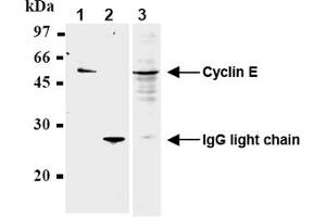 Western Blotting (WB) image for anti-Cyclin E1 (CCNE1) antibody (ABIN567784) (Cyclin E1 Antikörper)