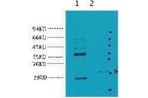 Western Blot (WB) analysis of 1) HeLa, 2) 293T, diluted at 1:5000. (CA9 Antikörper)