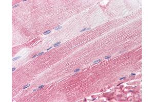 Anti-RAPSN / RAPSYN antibody IHC of human skeletal muscle. (RAPSN Antikörper  (AA 395-412))