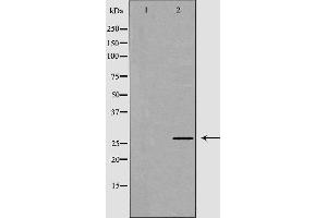 Western blot analysis of extracts of mouse livertissue, using NGF antibody. (Nerve Growth Factor Antikörper  (Internal Region))