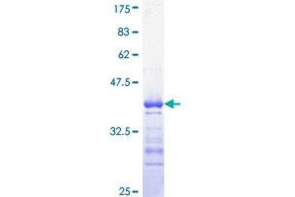 CDC25C Protein (AA 21-130) (GST tag)