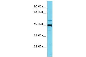 Host: Rabbit Target Name: SLC35E1 Sample Type: HepG2 Whole Cell lysates Antibody Dilution: 1. (SLC35E1 Antikörper  (C-Term))