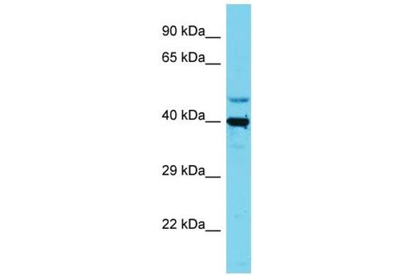 SLC35E1 Antikörper  (C-Term)