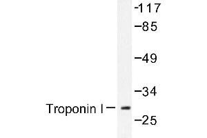 Image no. 1 for anti-Cardiac Troponin I (TNNI3) antibody (ABIN272087) (TNNI3 Antikörper)