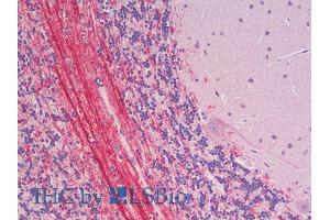 ABIN2613474 (5µg/ml) staining of paraffin embedded Human Cerebellum. (Robo3.2  (AA 1303-1316) Antikörper)
