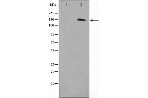 Western blot analysis on COLO205 cell lysate using MN1 Antibody,The lane on the left is treated with the antigen-specific peptide. (Meningioma 1 Antikörper  (Internal Region))