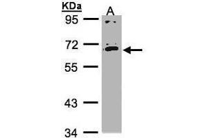 WB Image Sample(30 ug whole cell lysate) A:HeLa S3, 7. (IL17RC Antikörper)