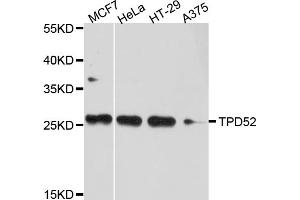 Western blot analysis of extracts of various cell lines, using TPD52 antibody. (TPD52 Antikörper)