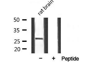 Western blot analysis of extracts from mouse Brian, using SPIC antibody. (SPIC Antikörper  (Internal Region))