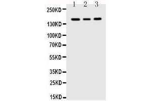 Anti-VEGF Receptor 1 antibody, Western blotting Lane 1: MCF-7 Cell Lysate Lane 2: SGC Cell Lysate Lane 3: MM231 Cell Lysate (FLT1 Antikörper  (C-Term))