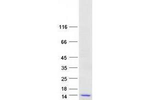 VKORC1 Protein (Transcript Variant 2) (Myc-DYKDDDDK Tag)