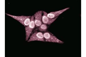 Immunofluorescent staining of HeLa cells. (RAN Antikörper  (AA 7-171))