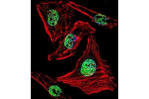 Fluorescent confocal image of Hela cell stained with ZBTB7B Antibody . (ZBTB7B Antikörper  (C-Term))