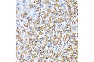 Immunohistochemistry of paraffin-embedded rat liver using Casein Kinase 1 alpha (Casein Kinase 1 alpha (CSNK1)) Rabbit mAb (ABIN7266098) at dilution of 1:100 (40x lens). (CSNK1A1 Antikörper)