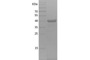 Western Blotting (WB) image for Actin Related Protein 2/3 Complex, Subunit 5-Like (ARPC5L) (AA 1-153) protein (His-IF2DI Tag) (ABIN7282022) (ARPC5L Protein (AA 1-153) (His-IF2DI Tag))