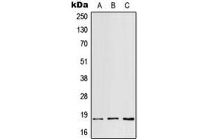 Western blot analysis of RPS18 expression in HepG2 (A), mouse spleen (B), H9C2 (C) whole cell lysates. (RPS18 Antikörper  (Center))