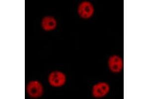 ABIN6274458 staining HepG2 cells by IF/ICC. (TAF15 Antikörper  (Internal Region))