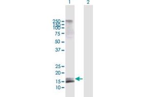 Western Blot analysis of AGTRAP expression in transfected 293T cell line by AGTRAP MaxPab polyclonal antibody. (AGTRAP Antikörper  (AA 1-152))