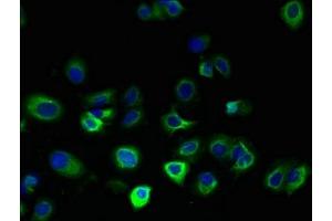 Immunofluorescent analysis of MCF-7 cells using ABIN7165422 at dilution of 1:100 and Alexa Fluor 488-congugated AffiniPure Goat Anti-Rabbit IgG(H+L) (FAM156A Antikörper  (AA 1-153))