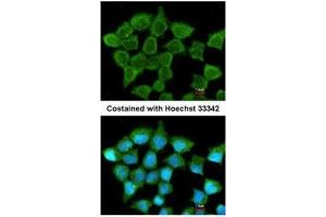 ICC/IF Image Immunofluorescence analysis of methanol-fixed A431, using SUCLA2, antibody at 1:200 dilution. (SUCLA2 Antikörper)
