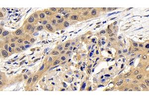 Immunohistochemistry (IHC) image for anti-Caspase 7, Apoptosis-Related Cysteine Peptidase (CASP7) (AA 207-303) antibody (ABIN7431803)