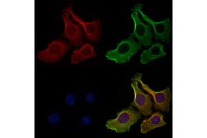 ABIN6262540 and ABIN6278895 staining Hela cells by IF/ICC.