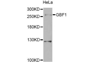 Western blot analysis of extracts of HeLa cells, using GBF1 Antibody. (GBF1 Antikörper)