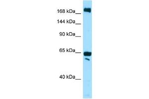 WB Suggested Anti-WNK2 Antibody Titration: 1. (WNK2 Antikörper  (N-Term))