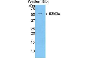 Western Blotting (WB) image for anti-Transglutaminase 1, Keratinocyte (TGM1) (AA 504-737) antibody (ABIN1860737) (TGM1 Antikörper  (AA 504-737))