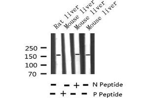 Western blot analysis of Phospho-EGFR (Thr678) expression in various lysates