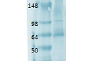 Western Blot analysis of Human thyroid lysate showing detection of Sodium Iodide Symporter protein using Mouse Anti-Sodium Iodide Symporter Monoclonal Antibody, Clone 14F . (SLC5A5 Antikörper  (AA 468-643) (Atto 390))