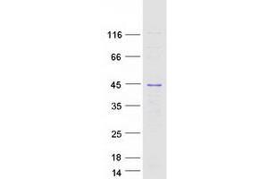 Western Blotting (WB) image for Heterogeneous Nuclear Ribonucleoprotein C (C1/C2) (HNRNPC) (Transcript Variant 1) protein (Myc-DYKDDDDK Tag) (ABIN2722911)
