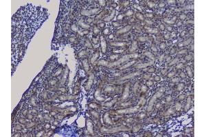 IHC analysis of NRF1 using anti-NRF1 antibody (ABIN6719347). (NRF1 Antikörper  (AA 246-503))